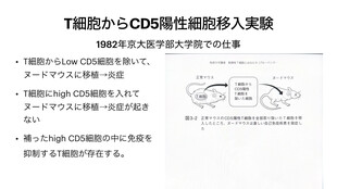 【画像】１９９５年にCD２５をマーカーとする制御性T細胞の存在を示す重要論文を発表しましたが、サイエンスやネイチャーには掲載拒否されました。しかし、アメリカ免疫学会の大物シュバック氏が論文の正しさを認め、ジャーナル・オブ・イミュノロジーに掲載されて日の目を見ることが可能になりました。CD４陽性細胞のみを投与すると自己免疫疾患が発症しますが、CD２５陽性の制御性T細胞を加えると病気が治るという実験で証明しました。１０年間のアメリカ滞在後、１９９８年に京大再生医学研究所(旧結核研究所)の教授として帰国し研究を継続しました。２００１年にブランコ氏とラムズデール氏がスカーフィーマウスの原因遺伝子としてFOXP３を発見し、人間のIPEX症候群との関連も明らかにしました。坂口先生はFOXP３遺伝子が制御性T細胞のマーカーであるCD２５陽性細胞にのみ発現することを発見し、普通のT細胞にFOXP３を導入すると制御性T細胞に変化することをサイエンス誌に発表して遺伝子レベルでの証明に成功しました。