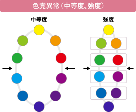 色覚異常（中等度、強度）